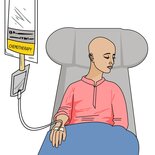 E learning kanker: Chemo en stralingen